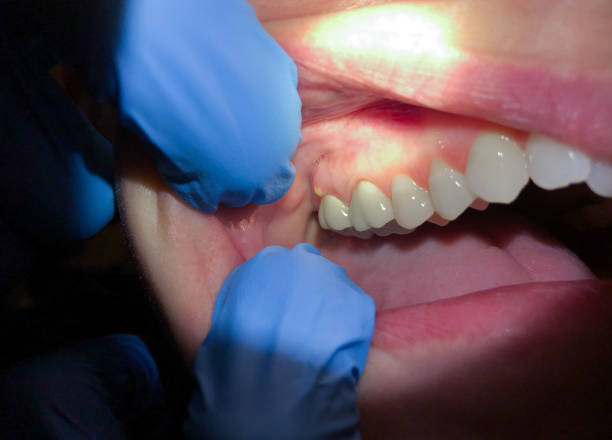 Best Broken or Cracked Tooth Emergency Dentist in Glennville, GA