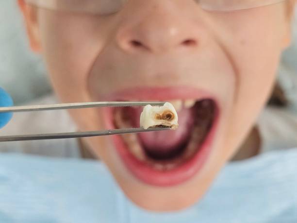 Best Weekend Emergency Dentist in Glennville, GA